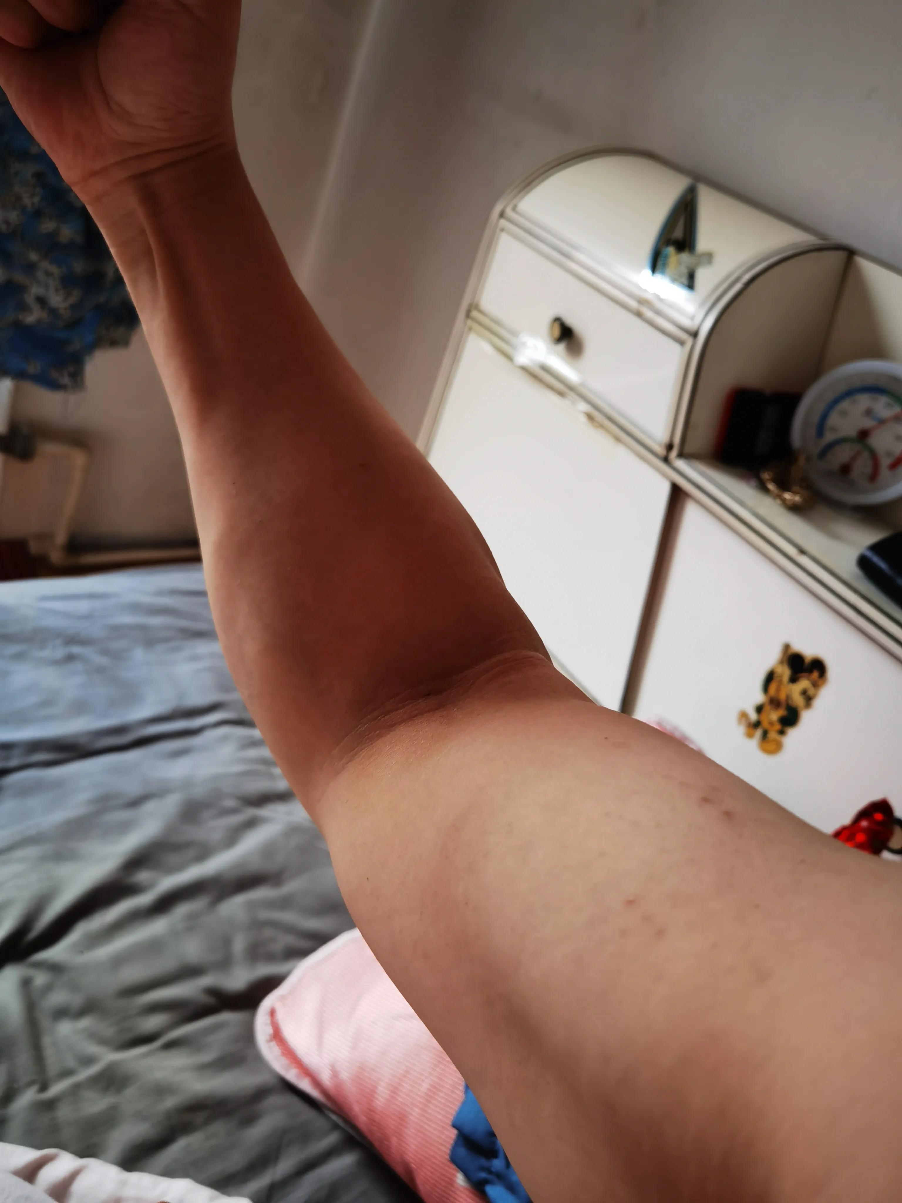 健身手套需要护腕吗_健身手套护腕有用吗_手套健身护腕需要戴吗