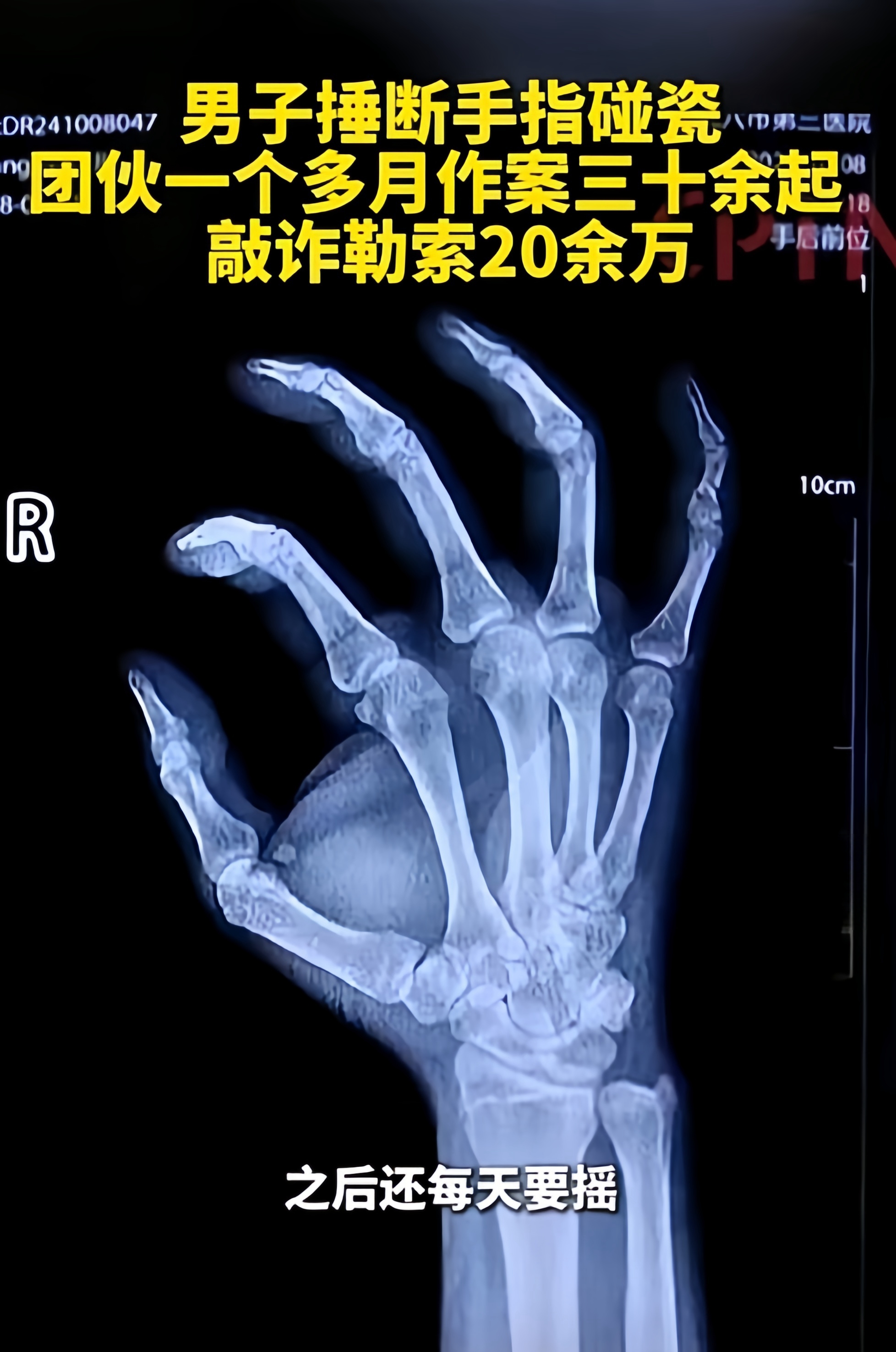 暴打碰瓷的视频_碰瓷被打视频大全_暴打碰瓷视频集锦