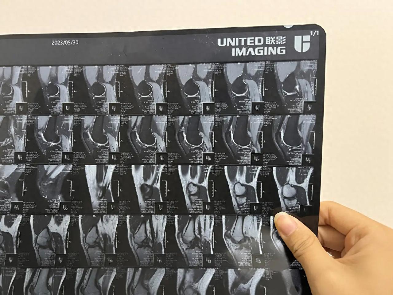 新澳门天天精准大全谜语王子 大坡度跑步机选购攻，易跑M5 Pro、麦瑞克X5、舒华A9跑步机测评