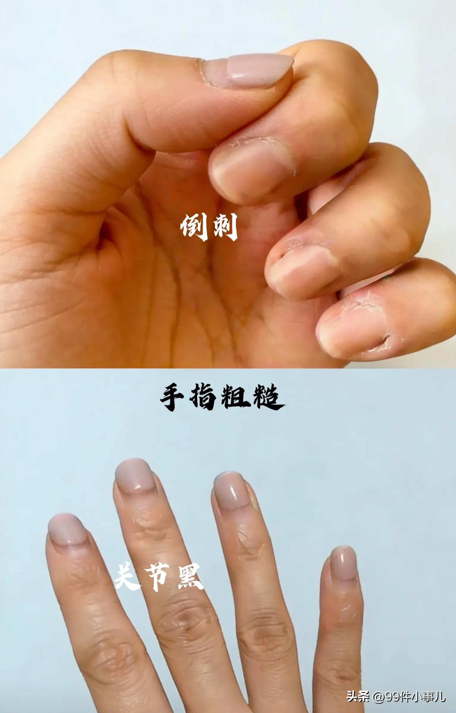 手部保养方法_10天手部保养周期_健身手套要贴紧还是松